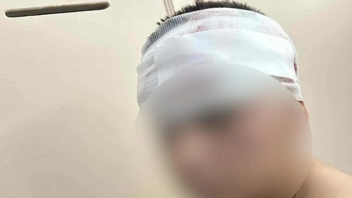 Θεσσαλονίκη: Σοκάρει ο πατέρας του 13χρονου που ξυλοκοπήθηκε άγρια από συμμορία ανηλίκων