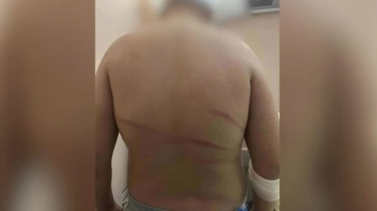 13χρονος δέχθηκε άγρια επίθεση με ξύλα από νεαρούς και νοσηλεύεται με σοβαρά τραύματα