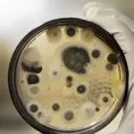 Συναγερμός για τον Candida auris: 451 κρούσματα στην Ελλάδα μόνο το 2023
