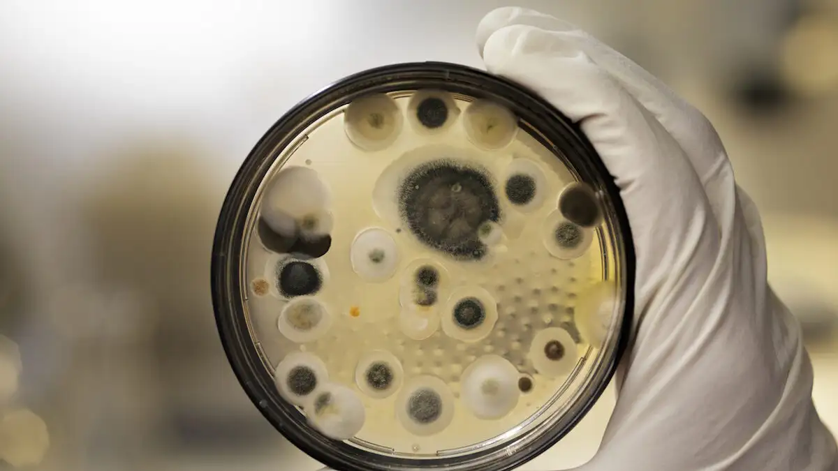 Συναγερμός για τον Candida auris: 451 κρούσματα στην Ελλάδα μόνο το 2023