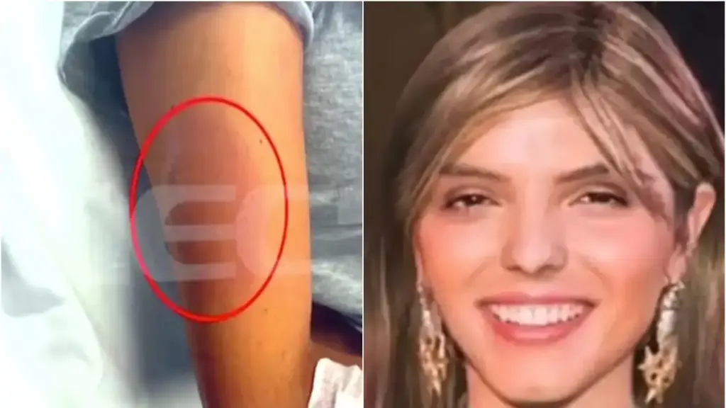 Ανατροπή με τα αίτια θανάτου της Μαρίσσας Λαιμού