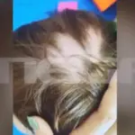 Ανατριχιαστική φωτογραφία από το 2χρονο αγοράκι που του ξερίζωσαν τα μαλλιά σε βρεφονηπιακό σταθμό
