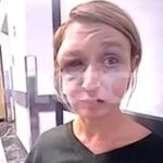 Τρομάζει η εικόνα της 40χρονης στο Κορωπί – Έχει αλλοιωθεί εντελώς το πρόσωπό της (vid)