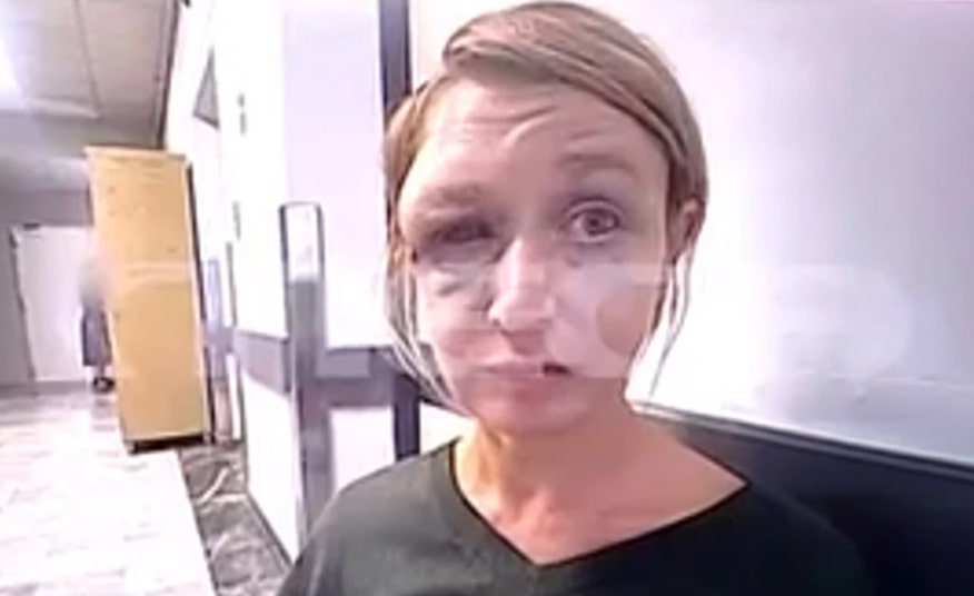 Τρομάζει η εικόνα της 40χρονης στο Κορωπί – Έχει αλλοιωθεί εντελώς το πρόσωπό της (vid)