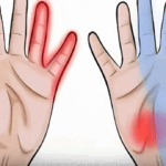 Μούδιασμα στα χέρια: Τα «καμπανάκια» που δεν πρέπει ποτέ να αγνοήσεις