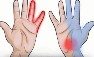 Μούδιασμα στα χέρια: Τα «καμπανάκια» που δεν πρέπει ποτέ να αγνοήσεις