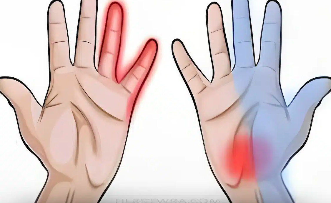 Μούδιασμα στα χέρια: Τα «καμπανάκια» που δεν πρέπει ποτέ να αγνοήσεις