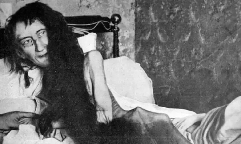 Η πιο τρομακτική φωτογραφία που έχει τραβηχτεί ποτέ – Η σοκαριστική ιστορία της