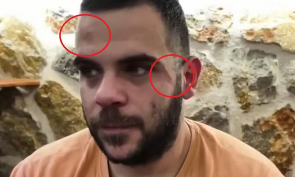 Άγριο ξύλο σε πασίγνωστο Έλληνα Youtuber στα Γιάννενα – Δείτε το video