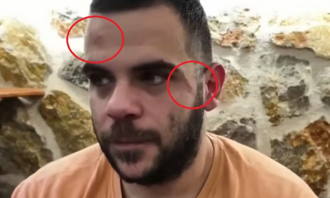 Άγριο ξύλο σε πασίγνωστο Έλληνα Youtuber στα Γιάννενα - Δείτε το video