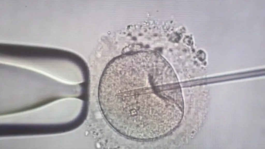 Αγωνία για 11 ελληνικές οικογένειες: Ο Δανός δότης με το μεταλλαγμένο γονίδιο και ο θάνατος παιδιού που άναψε συναγερμό