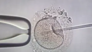 Αγωνία για 11 ελληνικές οικογένειες: Ο Δανός δότης με το μεταλλαγμένο γονίδιο και ο θάνατος παιδιού που άναψε συναγερμό