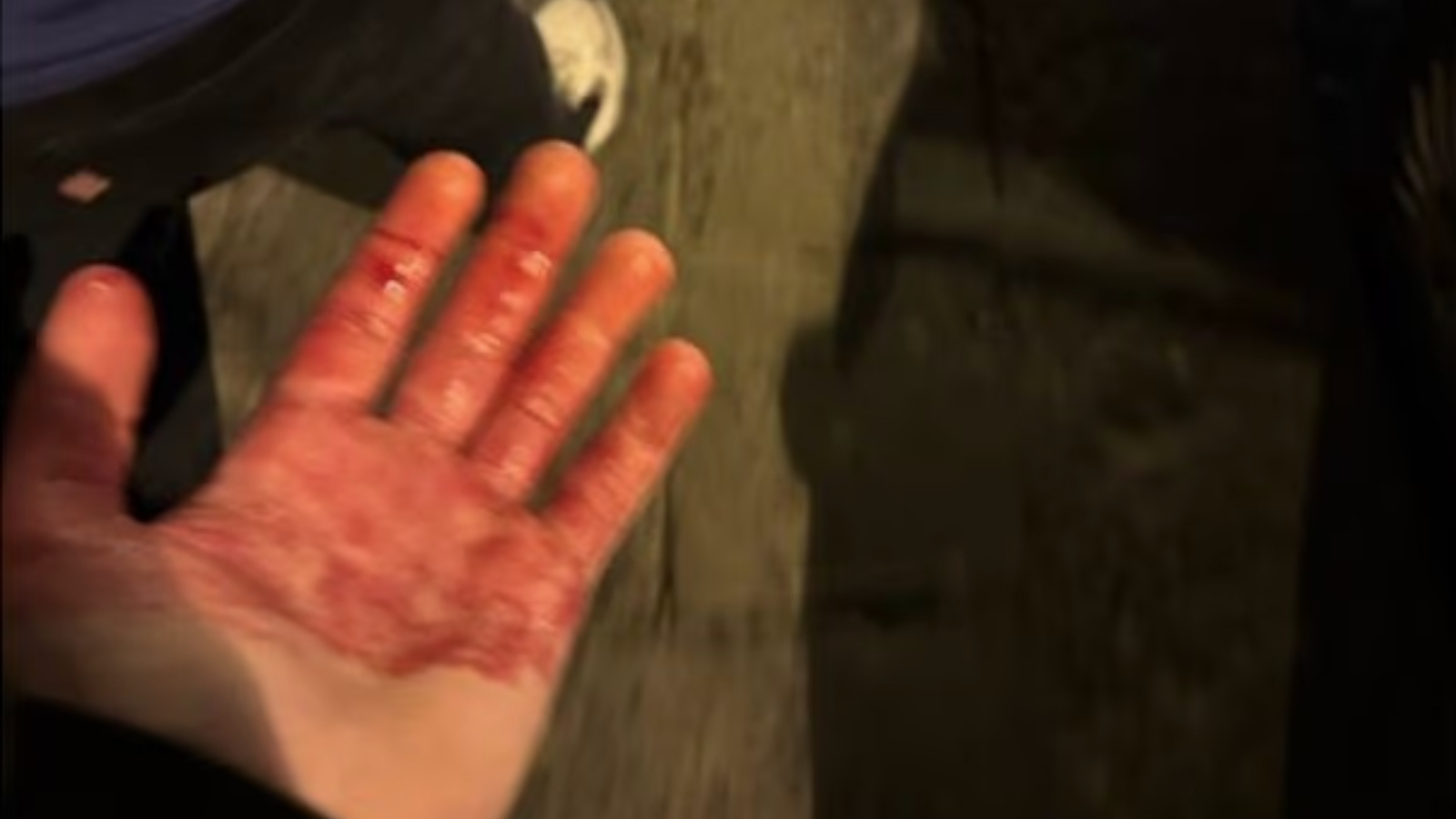 Σοκ: Οπαδοί δέχθηκαν επίθεση με μαχαίρια πριν από αγώνα Champions League