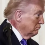 Τι συμβαίνει με τον Τραμπ; – Η αλήθεια για το εξάνθημα που έχει στο λαιμό του