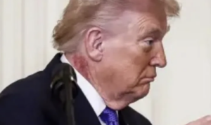 Τι συμβαίνει με τον Τραμπ; – Η αλήθεια για το εξάνθημα που έχει στο λαιμό του