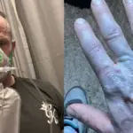 Ξύπνησε και ήταν όλος μπλε: Γιατί γελούσαν οι γιατροί όταν πήγε στο νοσοκομείο