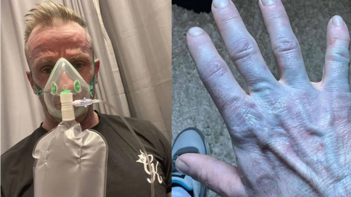 Ξύπνησε και ήταν όλος μπλε: Γιατί γελούσαν οι γιατροί όταν πήγε στο νοσοκομείο