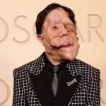 Αδιανόητη ασθένεια για πασίγνωστο παρουσιαστή – Εμφανίστηκε έτσι στα Όσκαρ