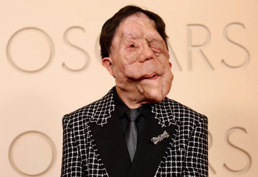 Αδιανόητη ασθένεια για πασίγνωστο παρουσιαστή - Εμφανίστηκε έτσι στα Όσκαρ